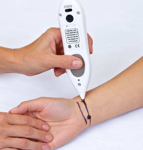 MPS (Micro-Current Point Stimulation) Therapy