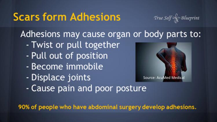 MPS Scar Release Therapy at Olla Terve, Pagosa Springs