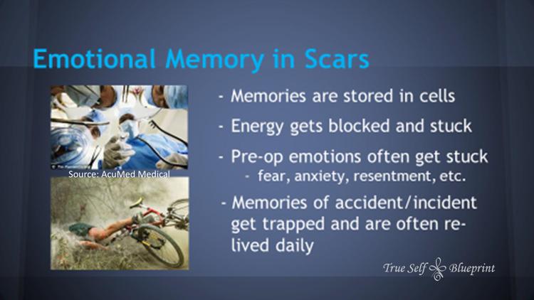 MPS Scar Release Therapy at Olla Terve, Pagosa Springs