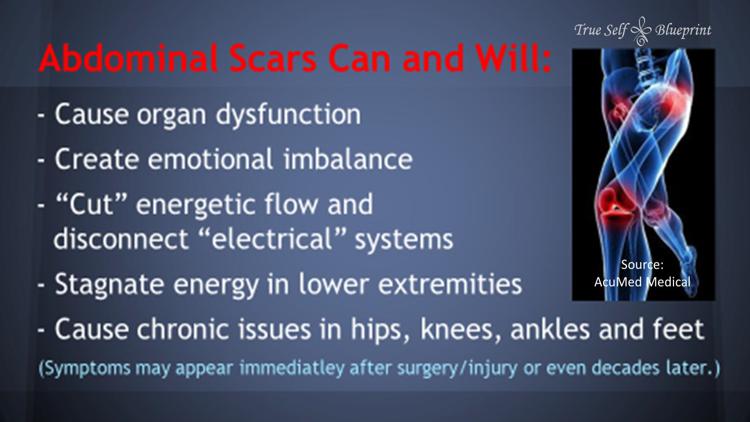 MPS Scar Release Therapy at Olla Terve, Pagosa Springs