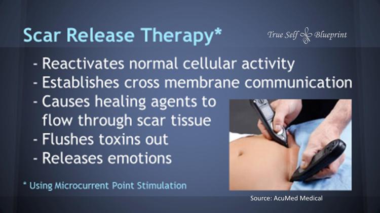 MPS Scar Release Therapy at Olla Terve, Pagosa Springs